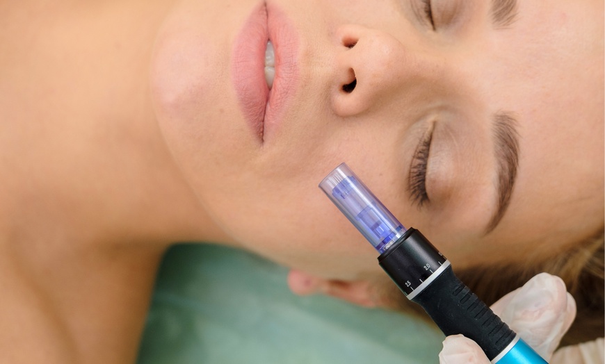 Image 1: Up to 60% Off Microneedling and PRP at Skinovatio Medical Spa